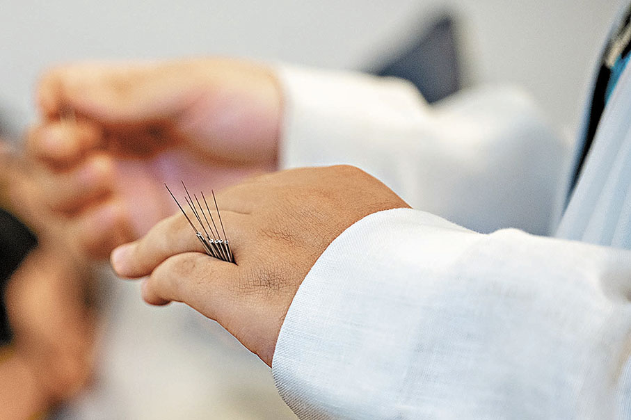 ◆針灸治療不孕症具有調陰陽、和氣血、調理腎肝脾之效。
