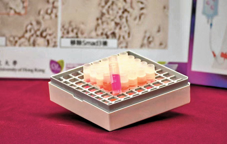 ◆圖為經實驗室培養基因編輯的抗癌「中性粒細胞」。