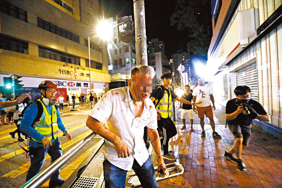 ◆當晚在元朗有市民遭暴徒襲擊以致頭破血流。 資料圖片