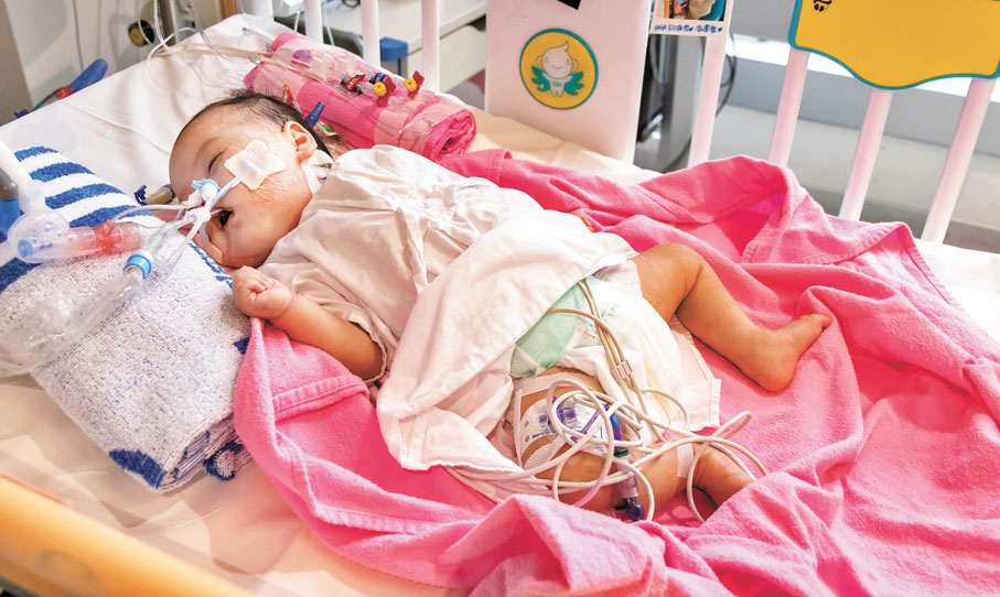◆香港女嬰芷希去年出現急性心衰竭命懸一線，幸獲內地一名腦死亡幼童捐出心臟延續生命，為兩地建立跨境器官移植互助機制開展新一頁。 資料圖片