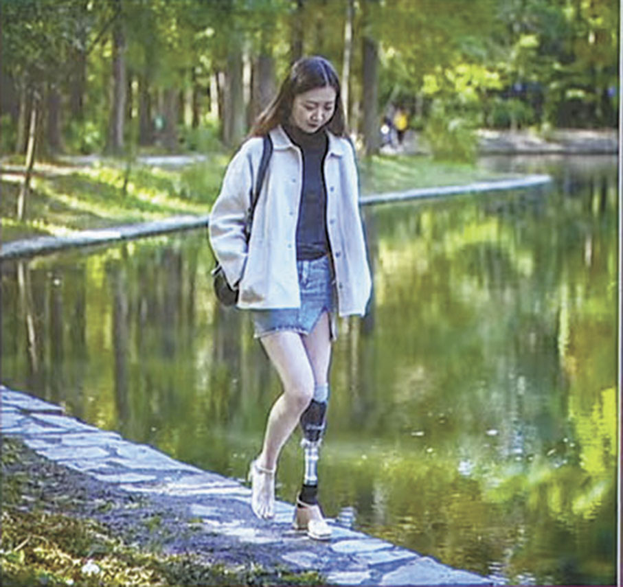 ◆ 魏雲露不再抗拒穿短裙。