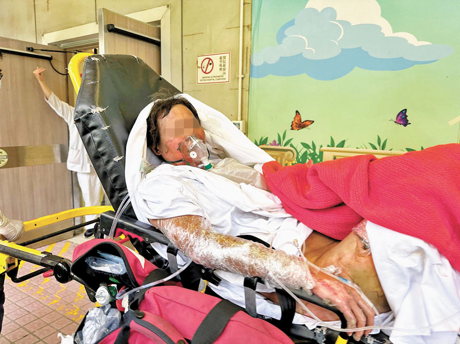 ◆案中涉嫌刺傷三家姐的大家姐七成皮膚燒傷，延至前晚不治。資料圖片