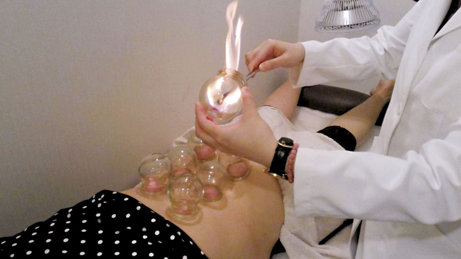 ◆中醫透過正骨復位等手法改善脊椎的排列，拔罐及刮痧等亦有助於緩和脊骨問題而引起的痛症。