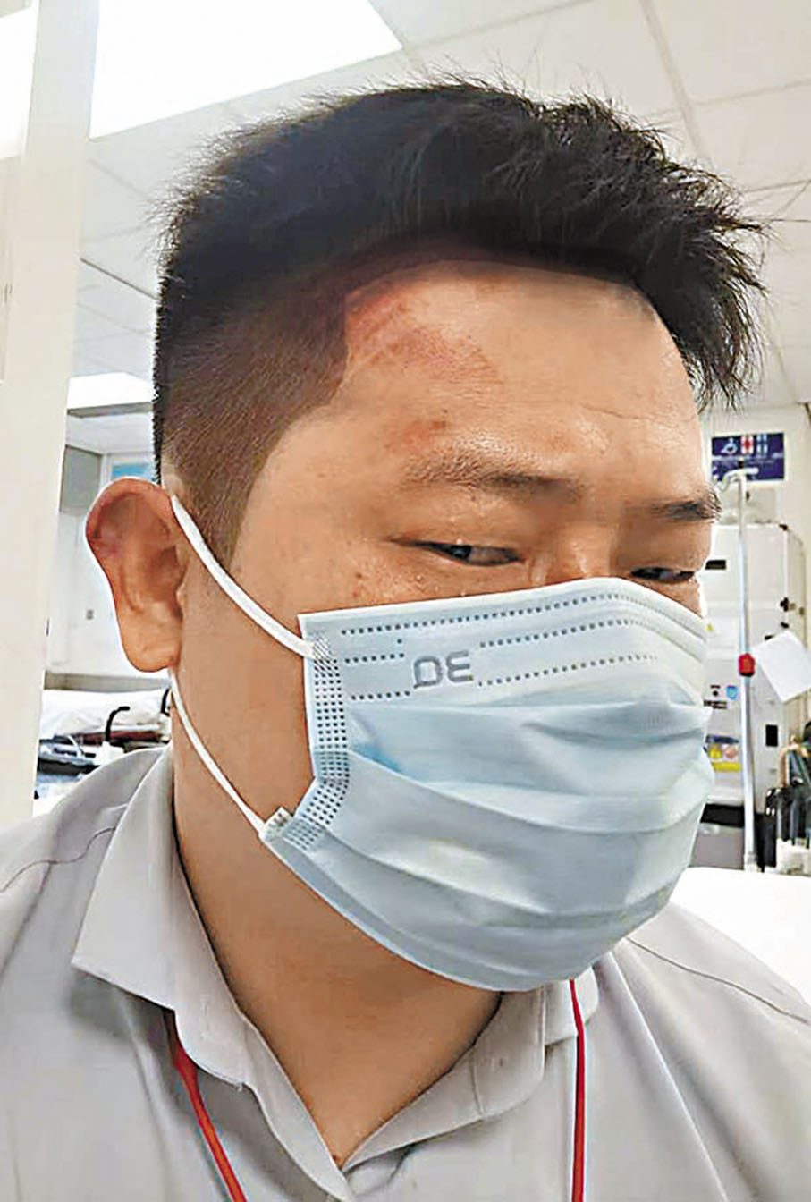 ◆內地投資者余先生，頭部有明顯遇襲受傷痕跡。受訪者供圖