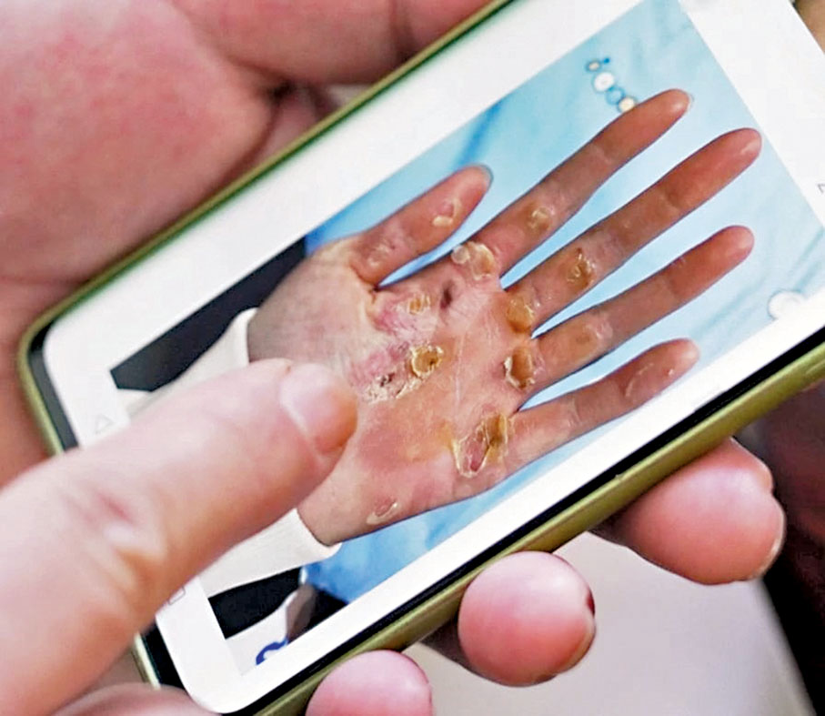 ◆鄒佳琪手掌充滿老繭的相片惹網友心痛。網上圖片