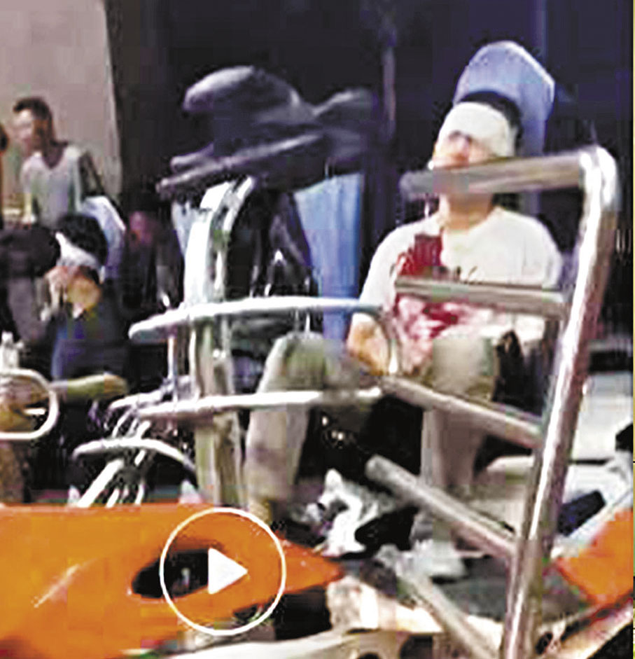 ◆事故中傷者正等候救治。 視頻截圖