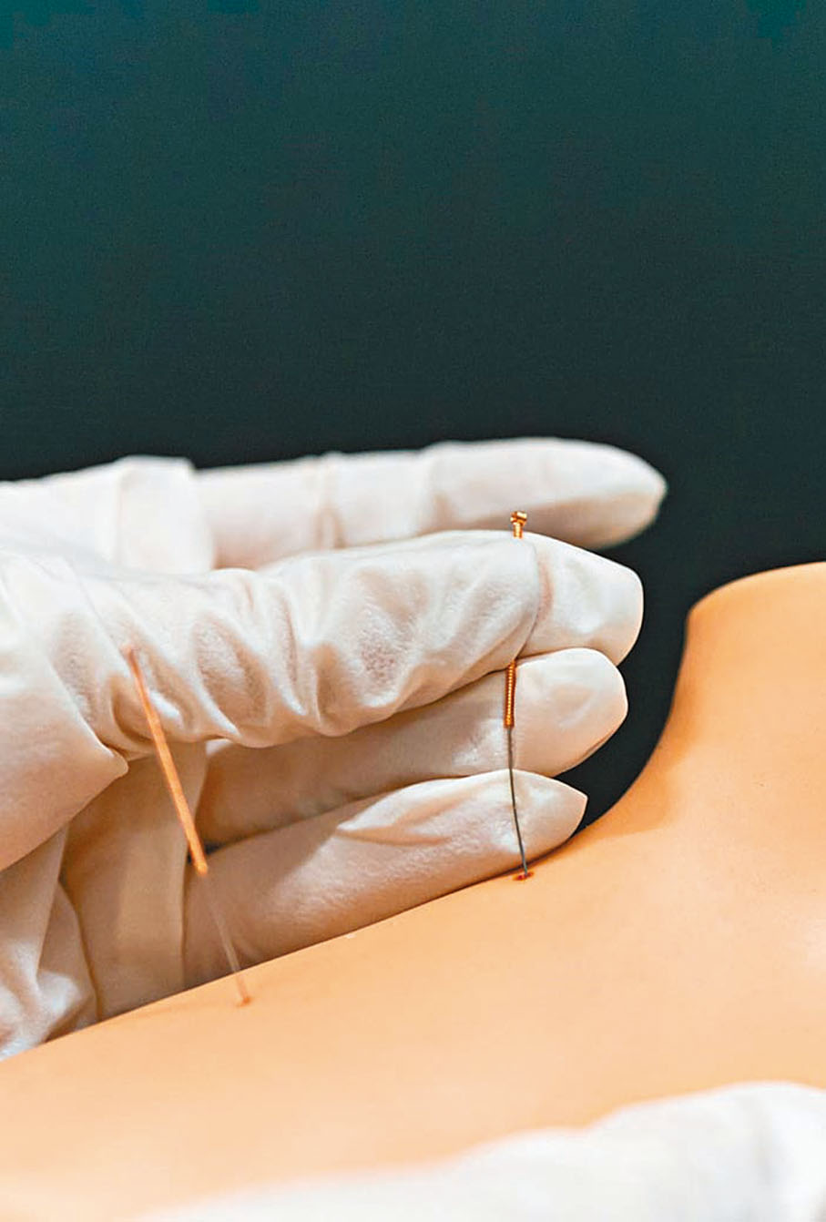 ◆中醫的中藥、針灸、推拿、拔罐、刮痧、天灸、耳針、藥浴、代茶飲、膏方等方法對預防和治療亞健康狀態有很好的效果。