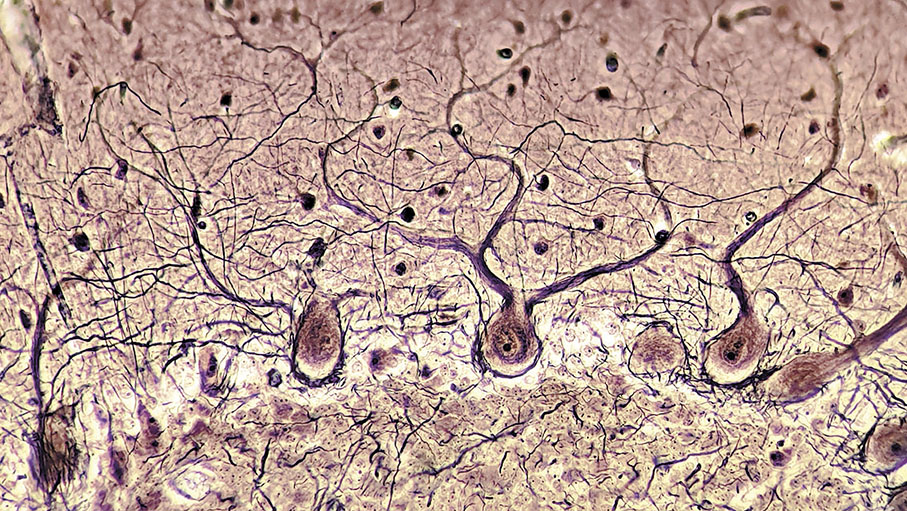 ● 小腦皮層的浦肯野神經細胞。 網上圖片