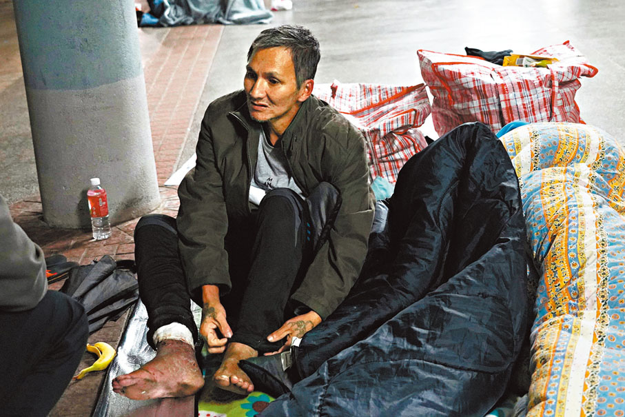 ●阿輝捲起褲管展示滿布傷口的腳部。香港文匯報記者曾興偉 攝