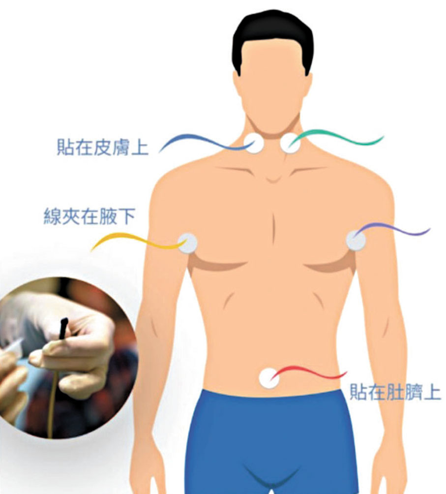 ●5個生物活性點