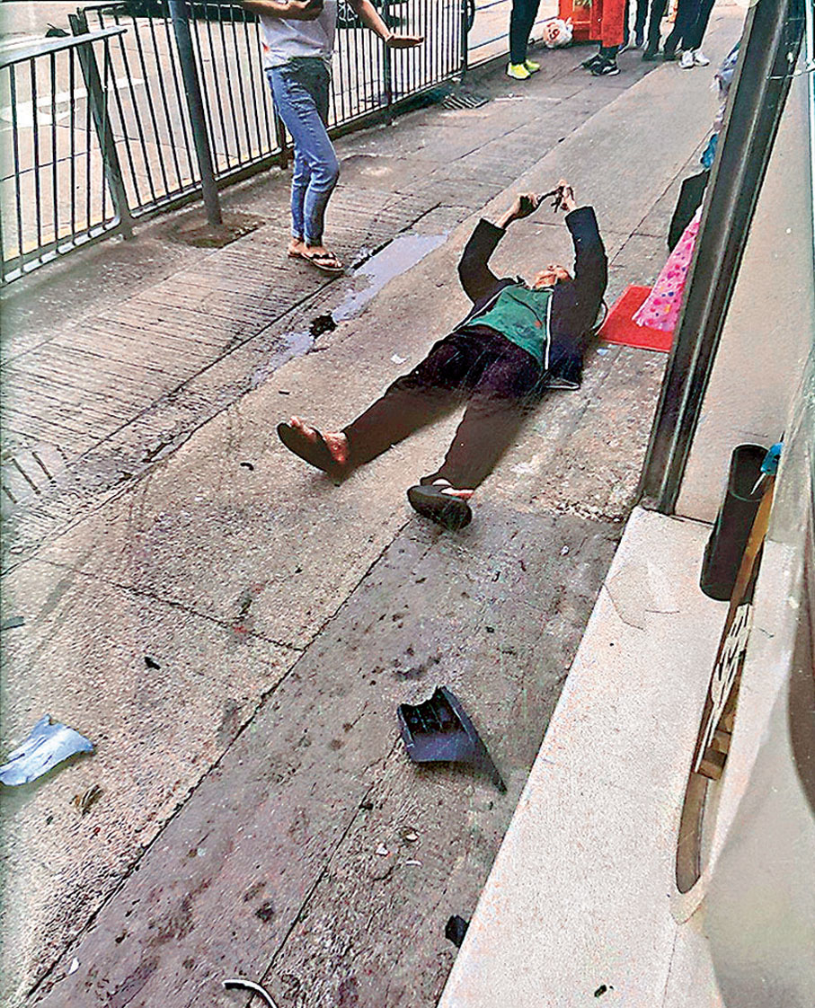 ●一名女途人逃避時受驚跌倒地上,受傷清醒待救。