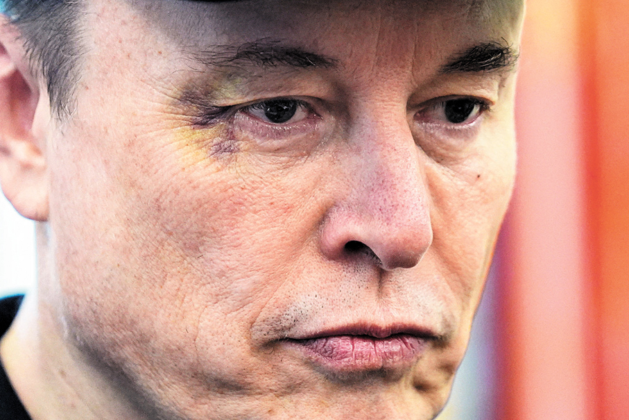 ●馬斯克右眼瘀傷成焦點。 美聯社