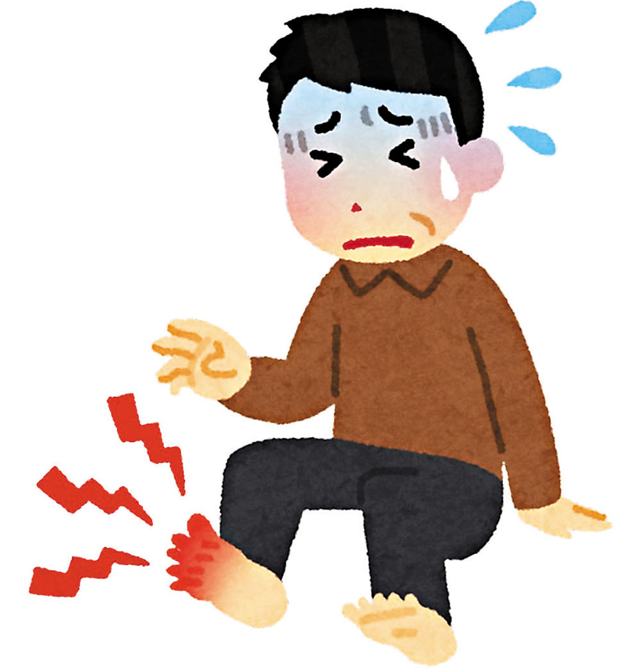 ●痛風所引起的痛楚強烈。