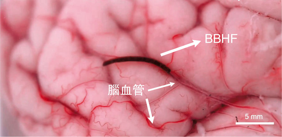 ●「磁控血液凝膠纖維機械人」（BBHF）非常柔軟、體積細小。