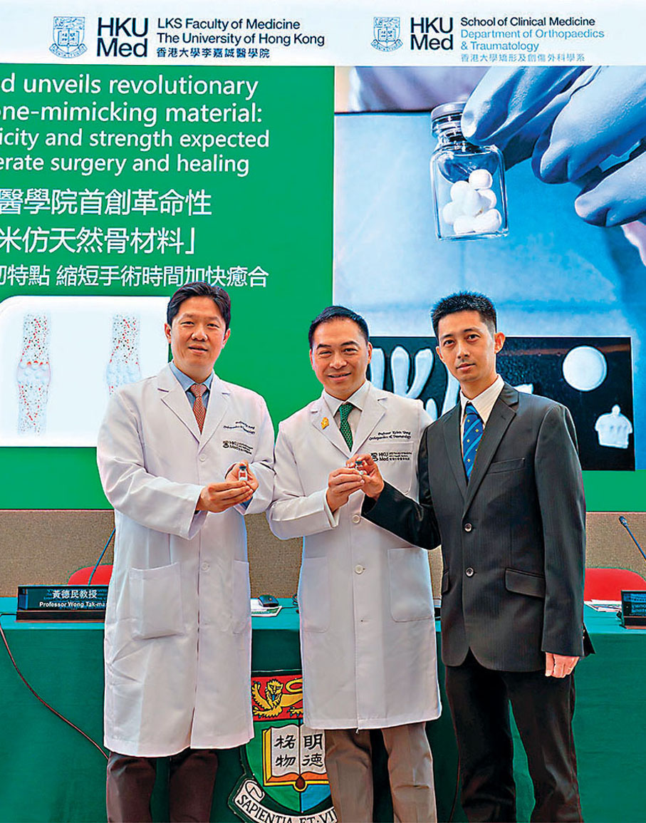 ●港大醫學院首創革命性「納米仿天然骨材料」助修復缺損大段骨。