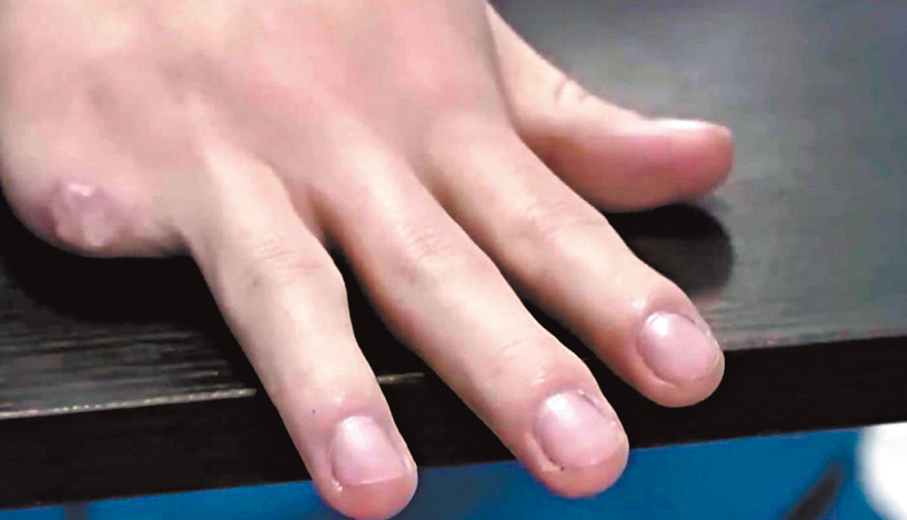 ●受害人手指被殘忍斬去。 視頻截圖