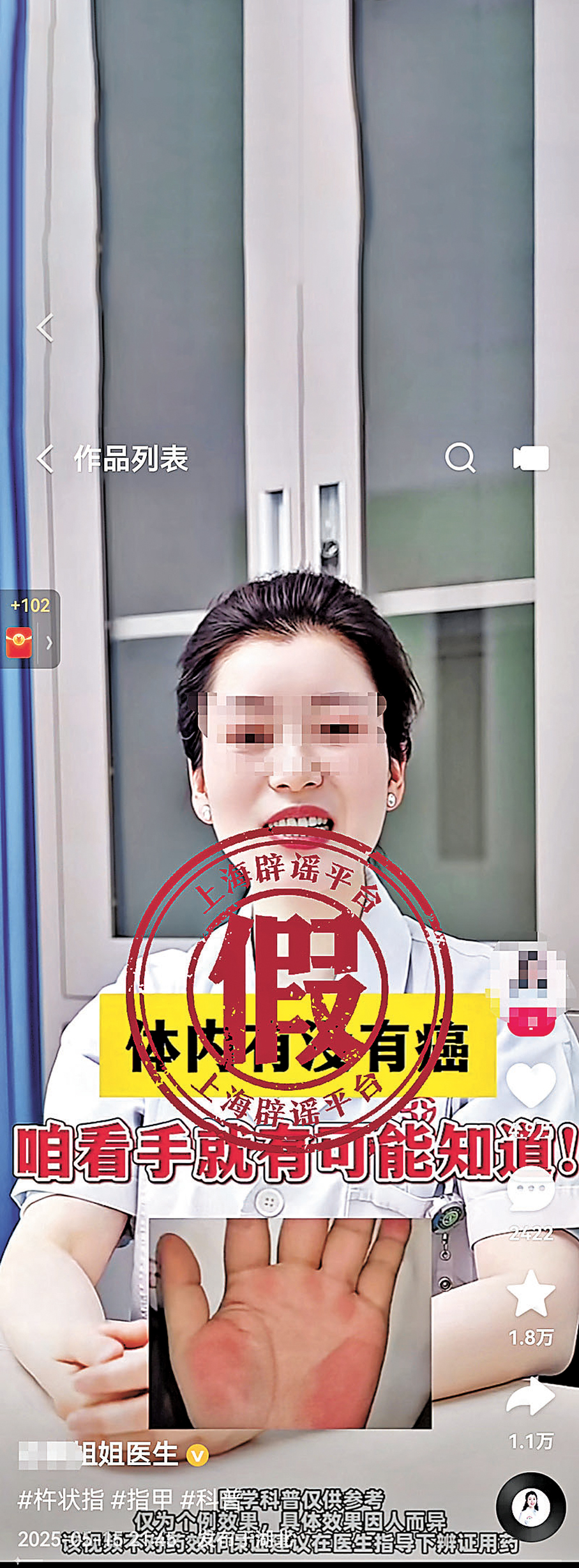 ●某皮膚科醫生發布「體內有沒有癌，看手就知道」的視頻。 網上圖片