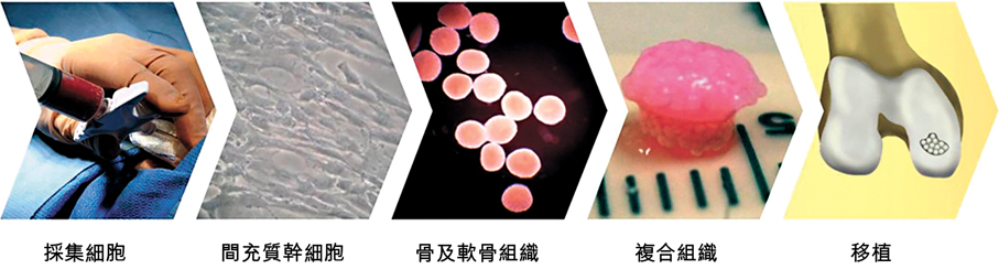 ●軟骨複合組織工程技術。 港中大圖片