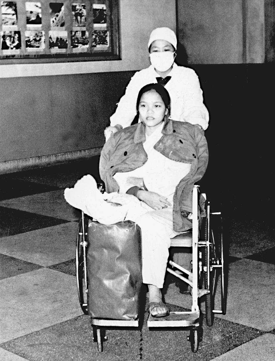 ●醫護人員照顧已經截肢的越南傷員。