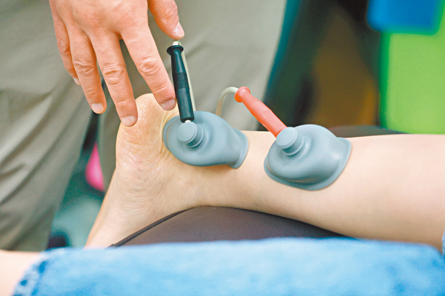 ●其中一種物理治療方式：干擾電流治療。