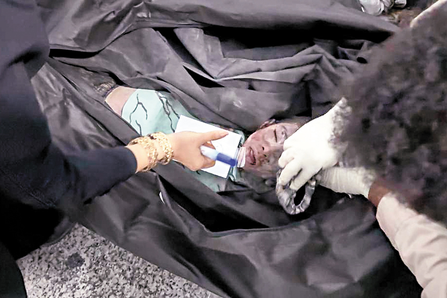 ●伊朗南部城市米納卜一間小學被炮彈擊中，造成至少148人死亡。圖為學童被抬出。 美聯社