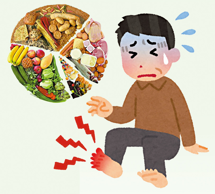 ●當代痛風高發，早已超越年齡與體質的限制，成為「吃出來」的時代病。