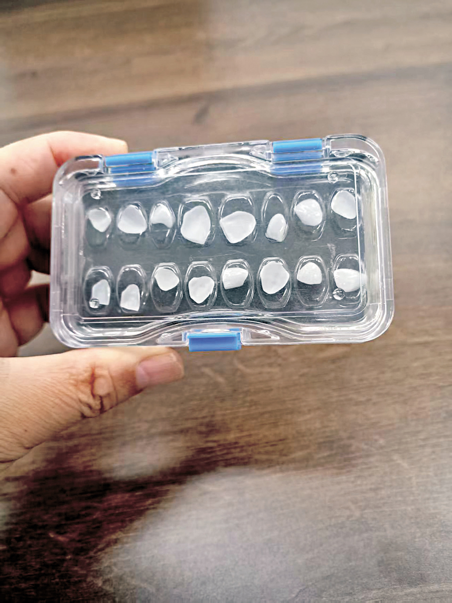 ●摩方精密3D打印機打印出來的厚度僅80微米的牙齒貼片。香港文匯報記者李昌鴻  攝