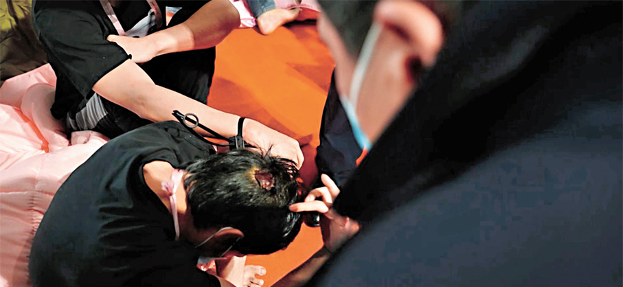 ●用AK47向中國逃跑人員射擊，一個傷疤細節揭開跨國大案。 央視新聞